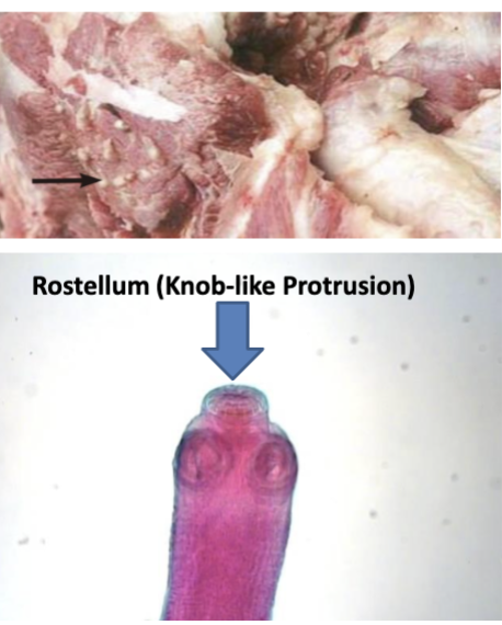 <p>Taenia solium </p>