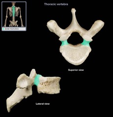 <p>Name this specific part of the thoracic vertebra.</p>