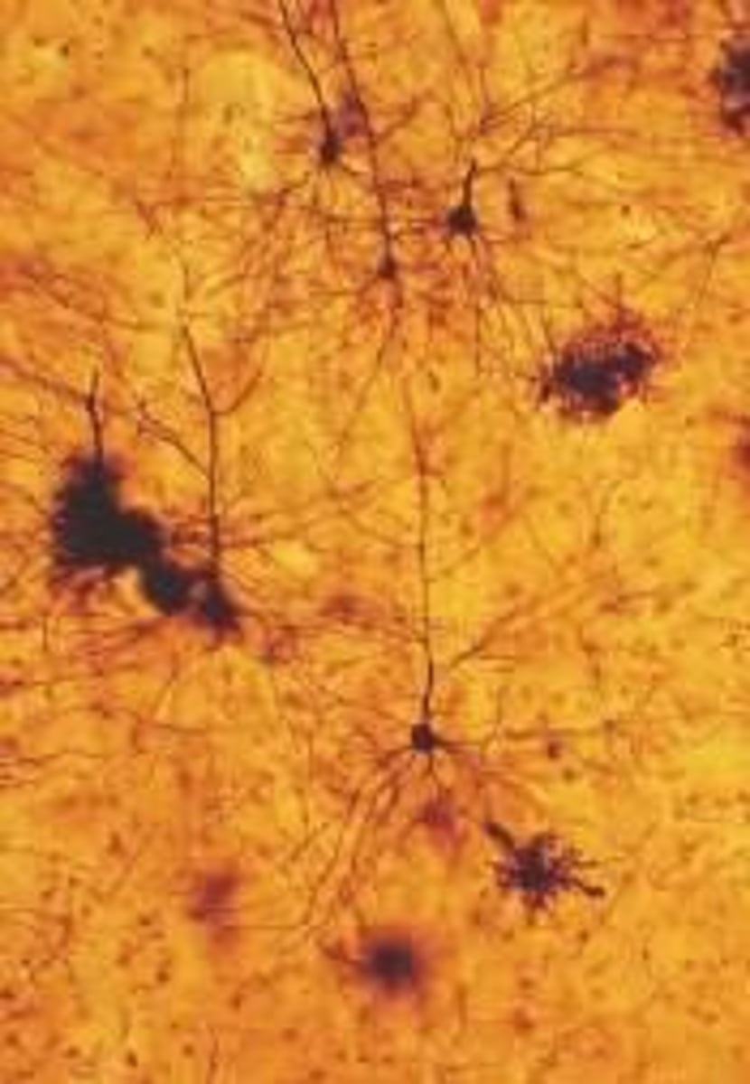 <p>Supportive cells in the nervous system that assist neurons.</p>