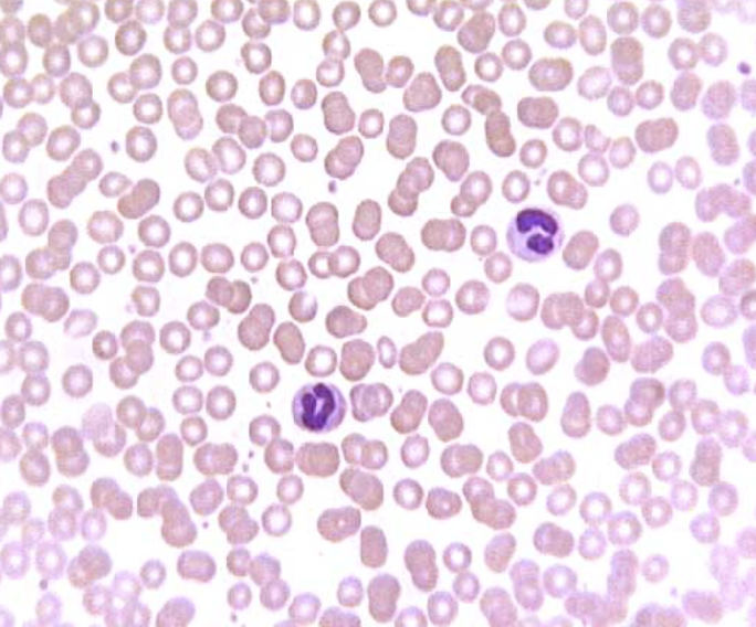 <ol><li><p>Sickle Cell Anemia</p></li><li><p>Atherosclerosis</p></li><li><p>Adenocarcinoma of Kidney</p></li><li><p>Osteogenic Sarcoma of Bone</p></li><li><p>Tattoo in Human Skin</p></li><li><p>Neurilemmoma</p></li><li><p>Anthracosis of the Lung</p></li><li><p>Basal Cell Carcinoma</p></li><li><p>Lung</p></li><li><p>Skeletal</p></li><li><p>Kidney</p></li><li><p>Neuron</p></li><li><p>Skin</p></li><li><p>Blood</p></li><li><p>Bone</p></li><li><p>Aorta</p></li></ol><p></p>
