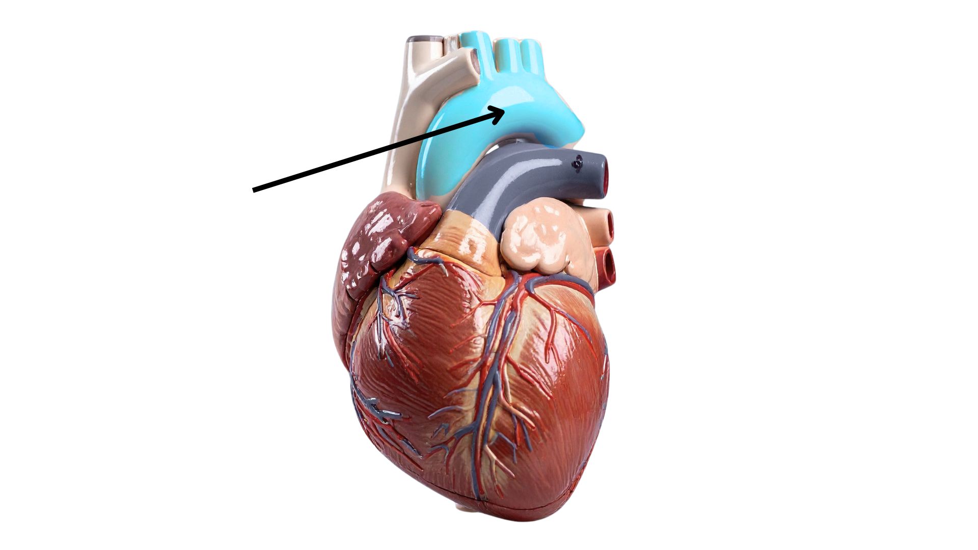 <p><span>What is the highlighted structure on the heart model below? [structure]</span></p>