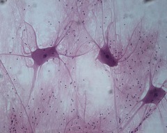 <p>Nervous tissue. Cells have lots of extensions</p>