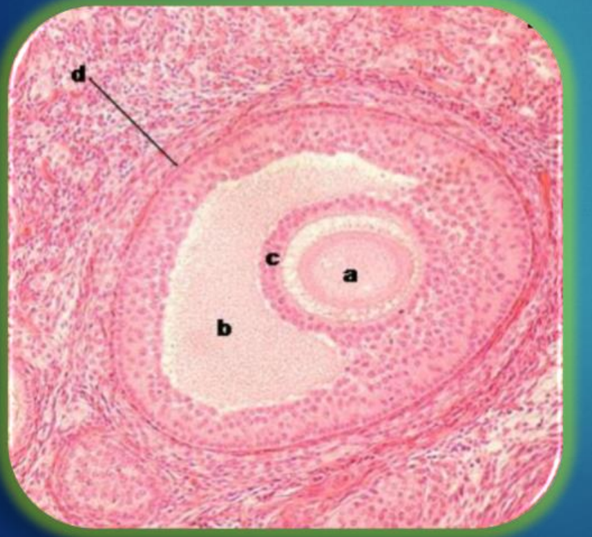 <p>What is a</p>