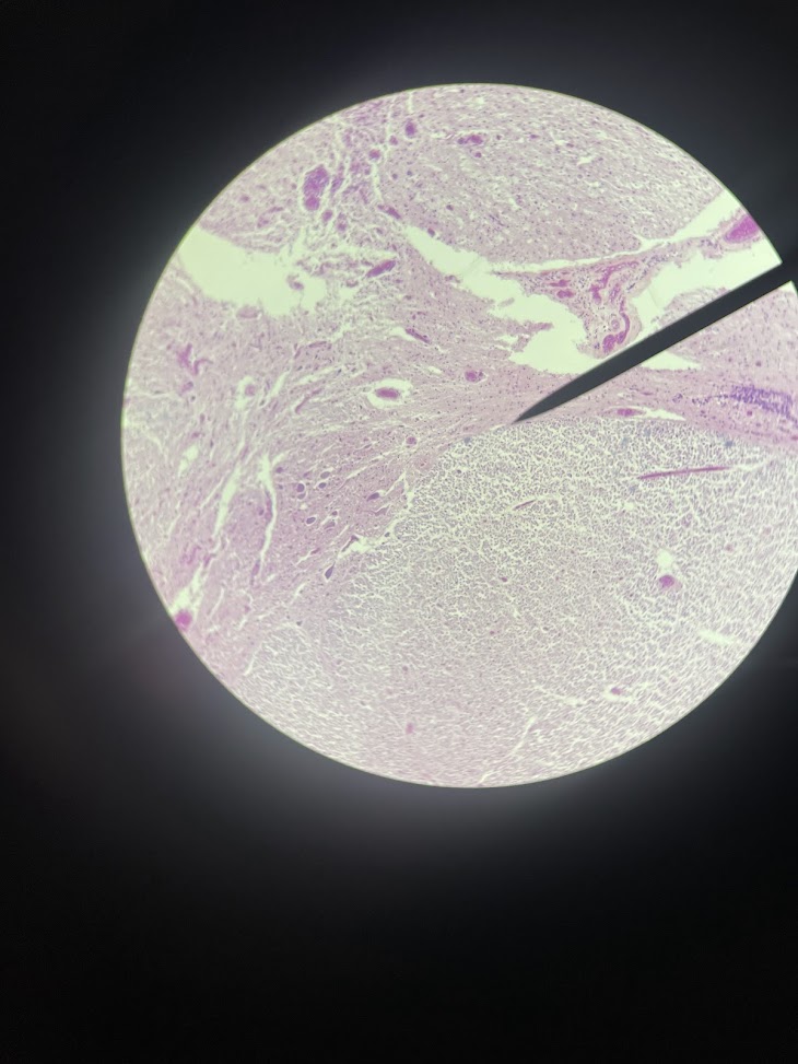 <p>tissue type above and below the pointer (spinal cord)</p>