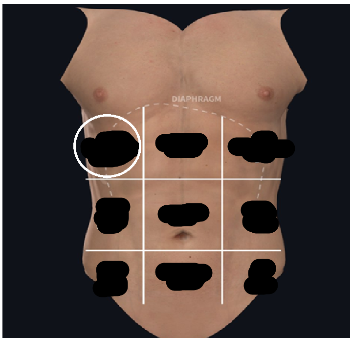<ul><li><p><span style="background-color: transparent;">Lateral the epigastric</span></p></li><li><p><span style="background-color: transparent;">Beneath lower ribs</span></p></li></ul><p></p>