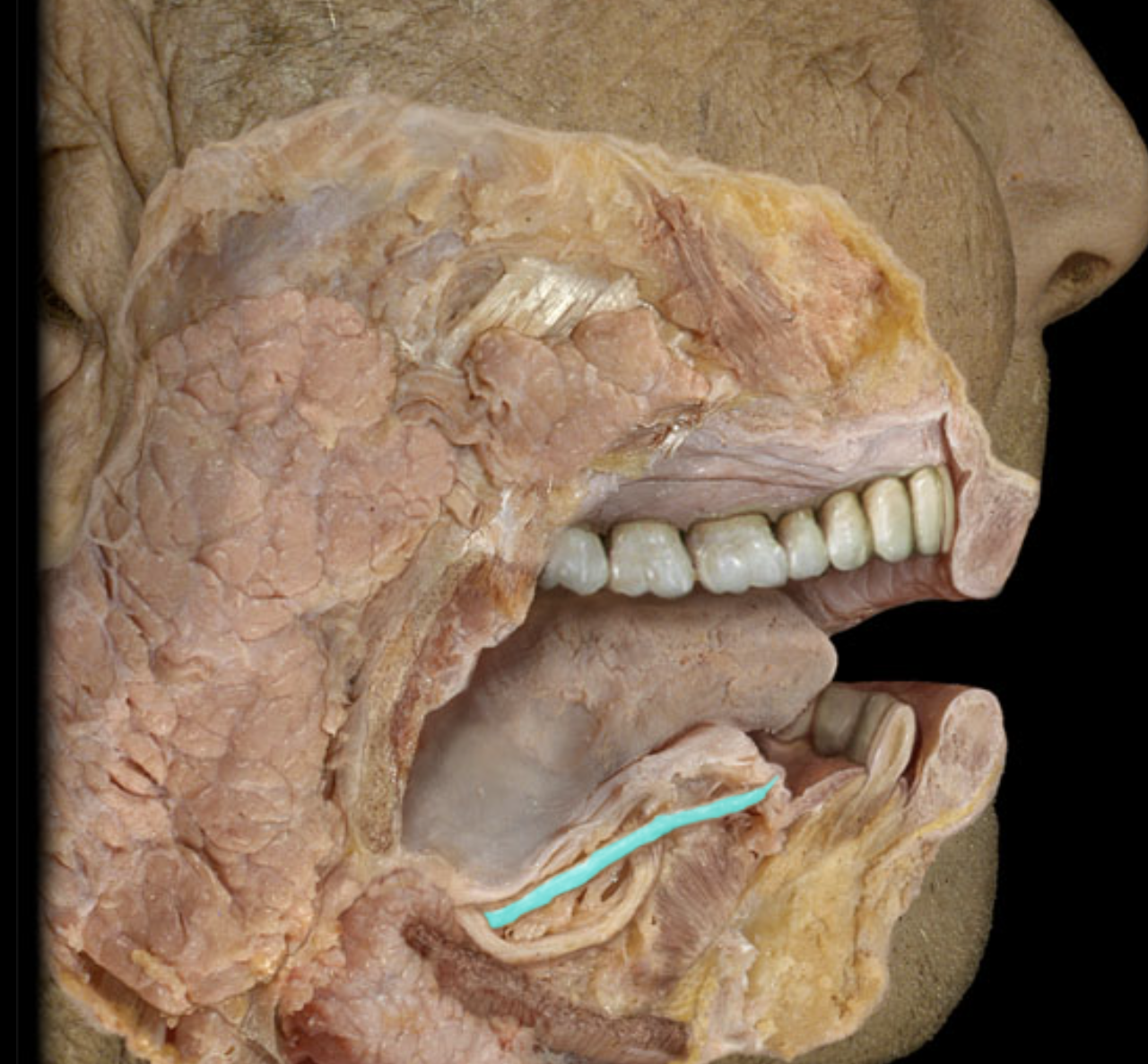 term image
