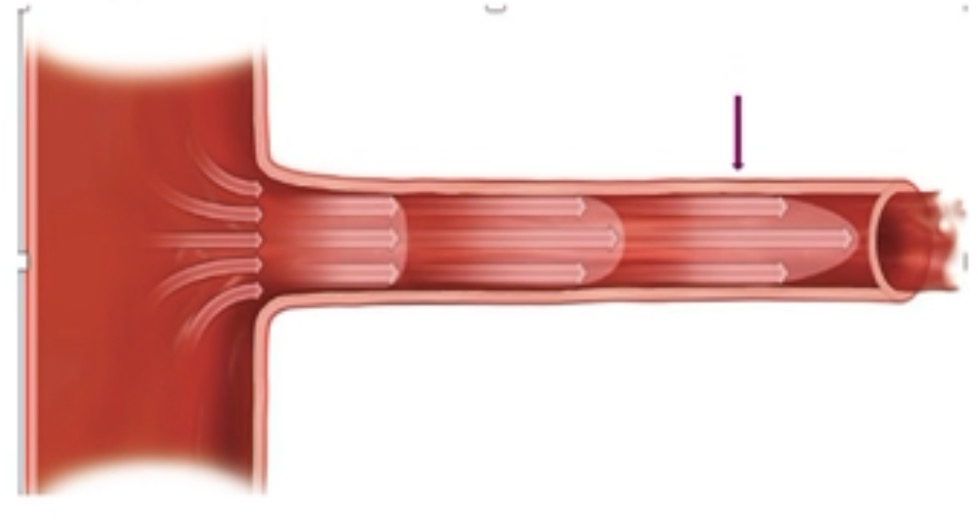<p>what flow is demonstrated here at the arrow?</p>