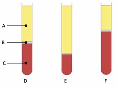<p>What is A pointing to in this example of a hematocrit tube?</p>