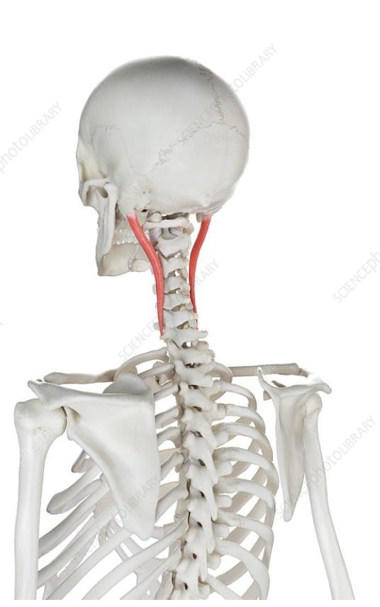 <p>Identify the highlighted muscle </p>