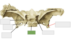 <p>This is</p>