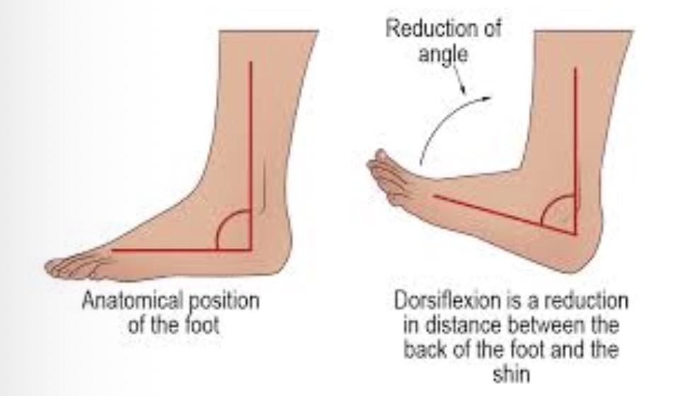 <p>backwards bending of a foot or hand to reduce distance between back of hand or foot and limb. </p>