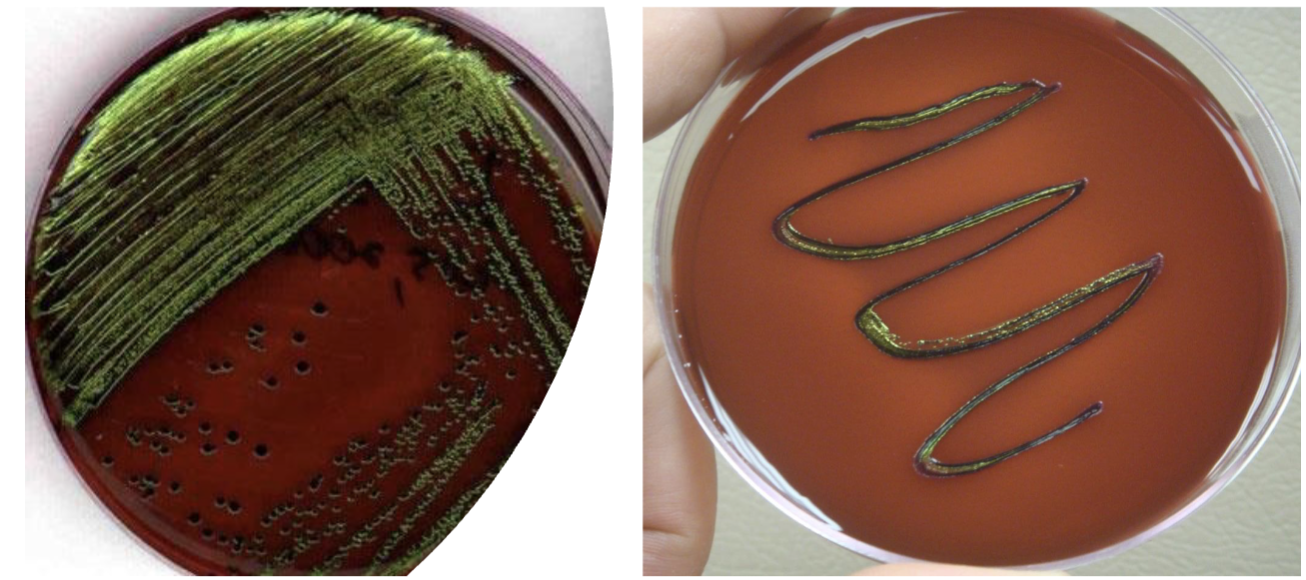 <p>Eosin Methylene Blue emb- E. coli why does it turn green?</p>