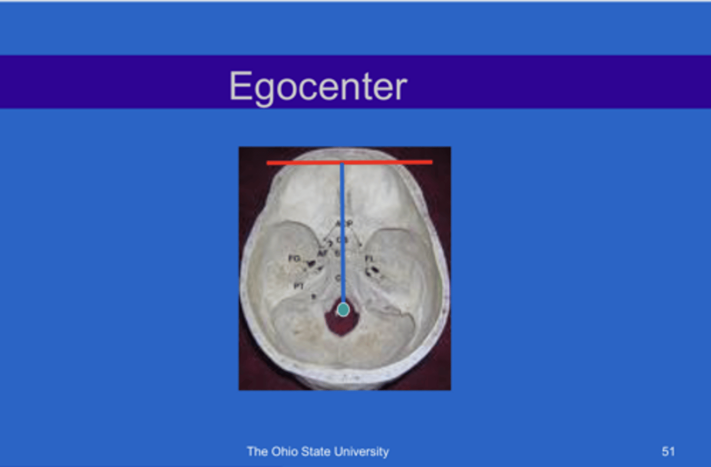<p>What is the result of finding the egocenter?</p>