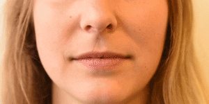 <p>Cheek Puffer</p>