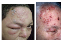 <p>What is the most likely diagnosis ?</p>