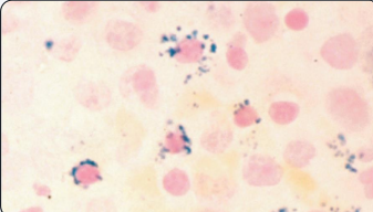 <p>what type of inclusions are these?</p>