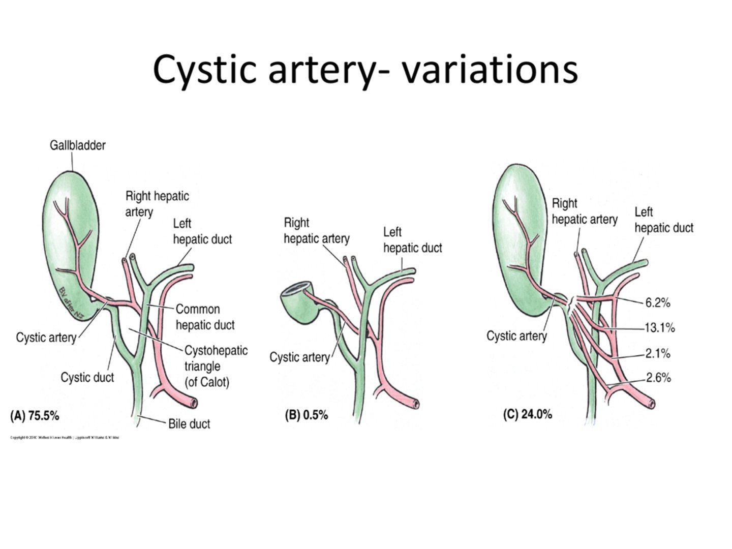 <p>75% are typical with 24% making up other variant important for surgery!</p>