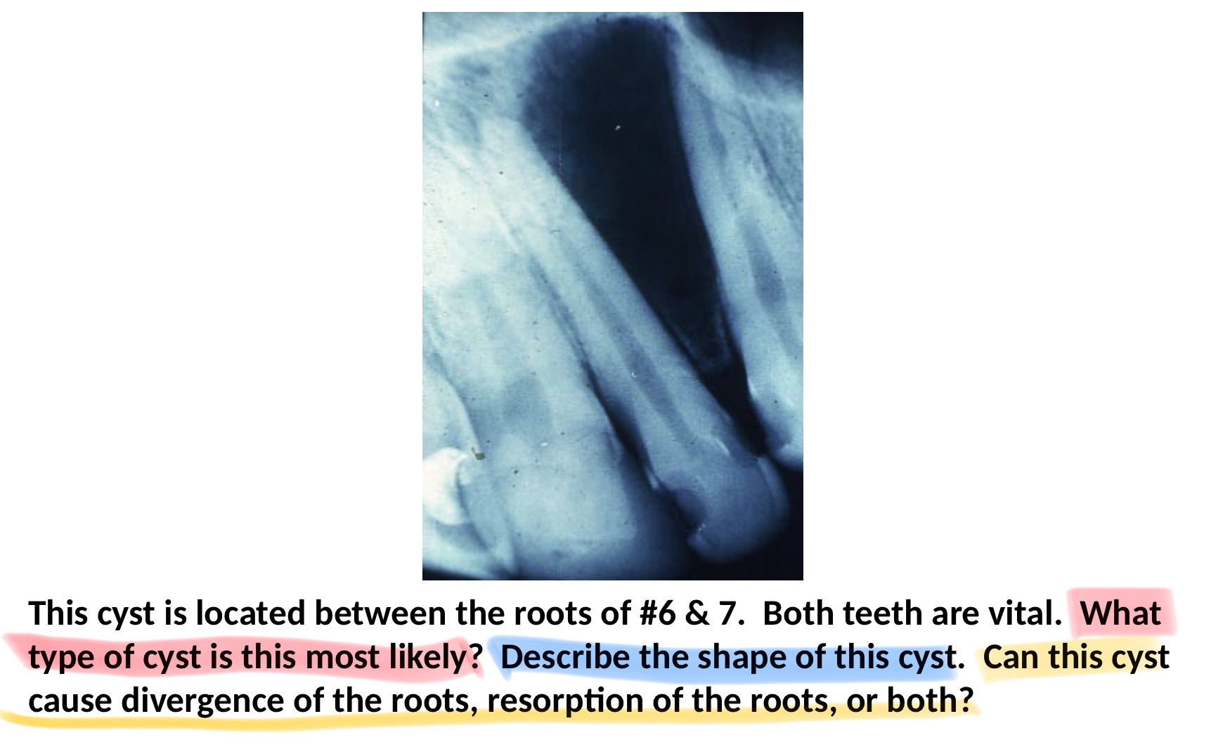 <p>yellow, occurs between lateral and canines</p>