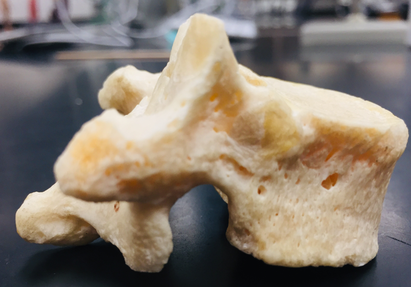 <p>thoracic vertebrae, demifacets, body, vertebral foramen, spinous process, transverse process, lamina, articulating process, intervertebral foramen</p>