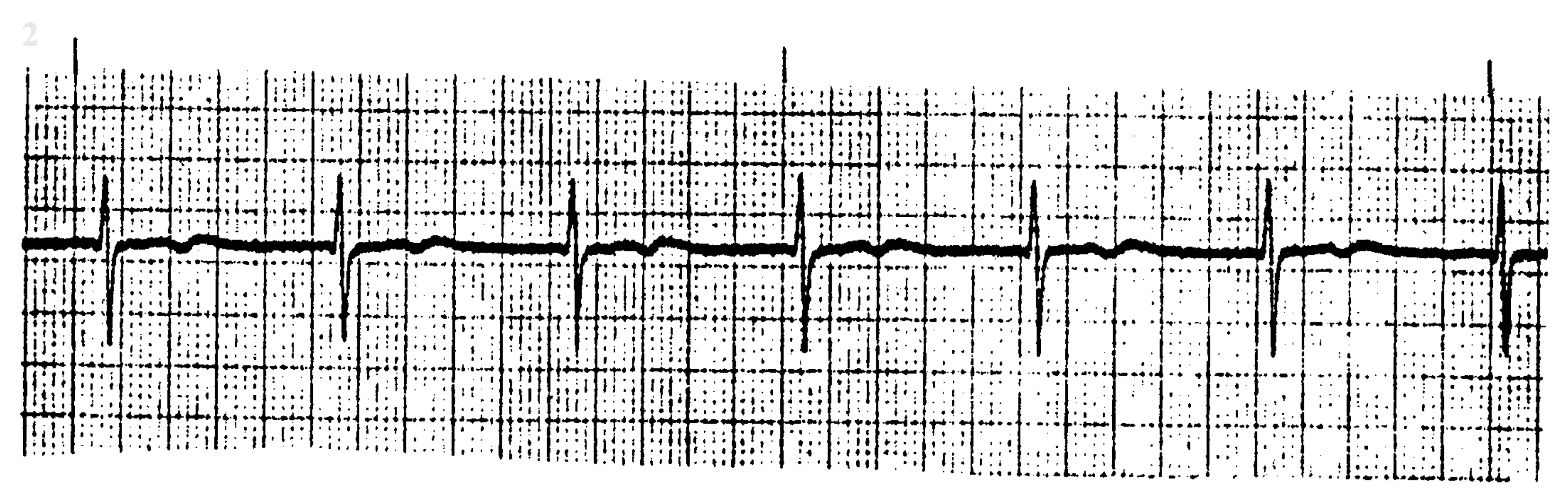 <p>What ECG is this? </p>