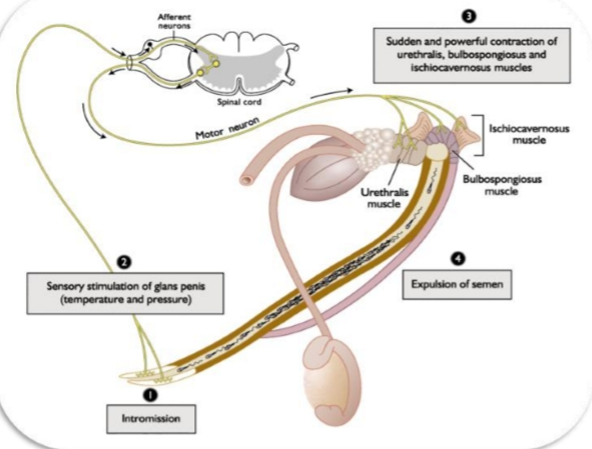<p>W<strong>hat the image is about</strong></p><p>It’s a diagram of the <strong>ejaculation reflex</strong> — a spinal reflex that coordinates sensory input from the penis with rapid, rhythmic muscle contractions that push semen out of the urethra.</p><p>Think of it as:<br><strong>Stimulus → Spinal cord reflex → Powerful pelvic muscle contractions → Semen expulsion</strong></p><div data-type="horizontalRule"><hr></div><p><span data-name="mag" data-type="emoji">🔍</span> <strong>Step‑by‑step explanation1. Intromission</strong></p><p>This just means <strong>penetration</strong>.<br>Once the penis is inside the reproductive tract, stimulation begins.</p><div data-type="horizontalRule"><hr></div><p><strong>2. Sensory stimulation of the glans penis</strong></p><p>The <strong>glans</strong> (tip of the penis) has dense sensory receptors for:</p><ul><li><p><strong>Pressure</strong></p></li><li><p><strong>Temperature</strong></p></li><li><p><strong>Touch</strong></p></li></ul><p>These sensory signals travel through <strong>afferent neurons</strong> to the <strong>lumbosacral spinal cord</strong>.</p><p>This is important:<br><strong>Ejaculation is controlled by a spinal reflex center — not the brain.</strong></p><div data-type="horizontalRule"><hr></div><p><strong>3. Spinal reflex activates pelvic muscles</strong></p><p>The spinal cord sends <strong>motor signals</strong> back to specific muscles:</p><ul><li><p><strong>Urethralis muscle</strong><br>Squeezes the urethra like a pump.</p></li><li><p><strong>Bulbospongiosus muscle</strong><br>Provides the strongest contractions that actually <em>propel</em> semen.</p></li><li><p><strong>Ischiocavernosus muscle</strong><br>Stabilizes the penis and increases pressure inside erectile tissue.</p></li></ul><p>These muscles contract <strong>suddenly and powerfully</strong>, in rhythmic bursts.</p><div data-type="horizontalRule"><hr></div><p><strong>4. Expulsion of semen</strong></p><p>Those coordinated contractions force semen through the urethra and out of the body.</p><p>This is the <strong>ejaculatory phase</strong>, following emission (movement of semen into the urethra).</p><div data-type="horizontalRule"><hr></div><p><span data-name="jigsaw" data-type="emoji">🧩</span> <strong>Why this matters physiologically</strong></p><ul><li><p>Ejaculation is <strong>not voluntary</strong> once the reflex is triggered.</p></li><li><p>It depends on <strong>sensory input</strong>, <strong>spinal integration</strong>, and <strong>striated muscle contractions</strong>.</p></li><li><p>The muscles involved are the same ones used in <strong>pelvic floor function</strong>.</p></li></ul><p></p>