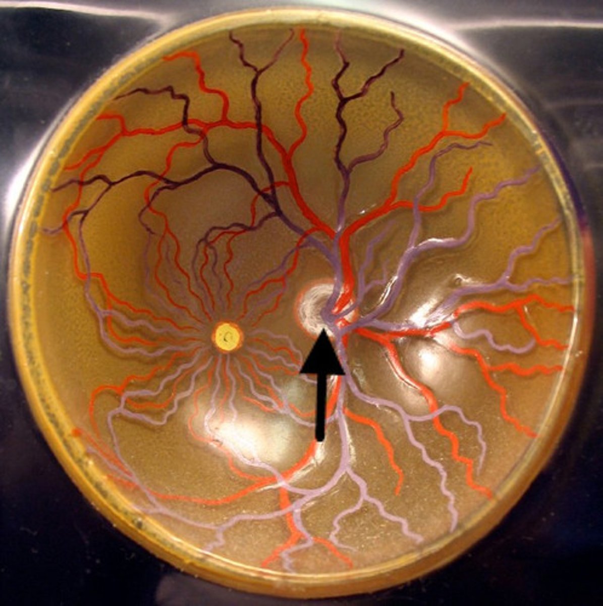 <p>Name this structure of the eyeball</p>