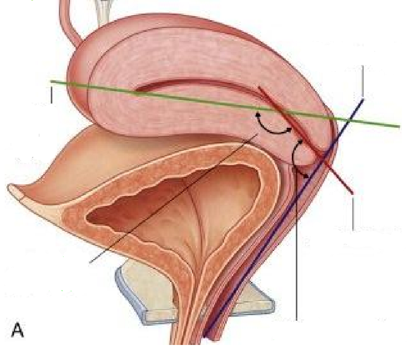 <p>Label the following diagram of the axes & angles of the uterus</p>
