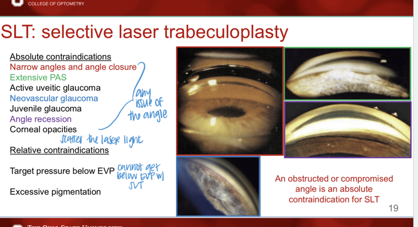<p>What are the absolute contraindications of SLT?</p>