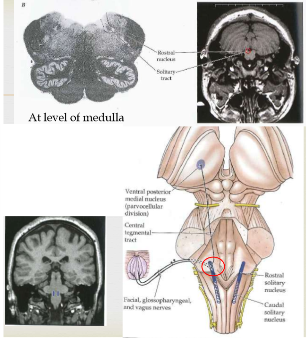 <p>Rostral solitary nucleus in blue</p>