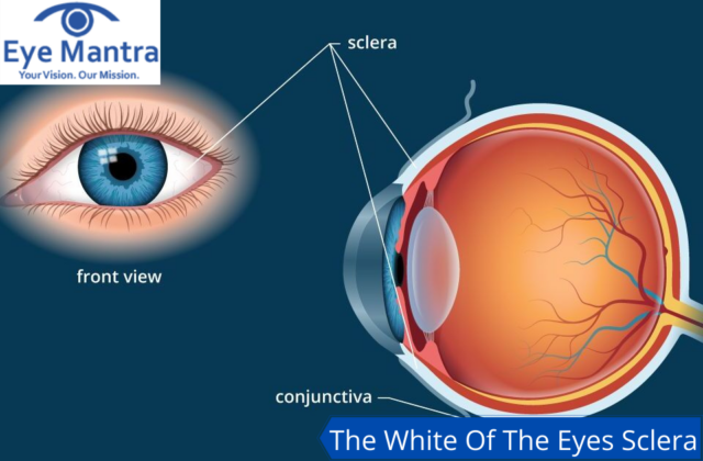 <p>White portion of the eye</p>