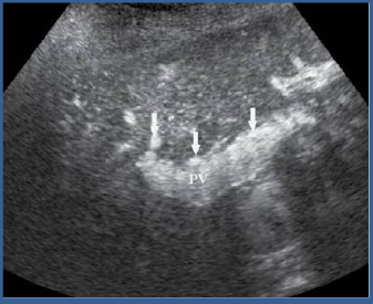 <p>what phase is this</p>