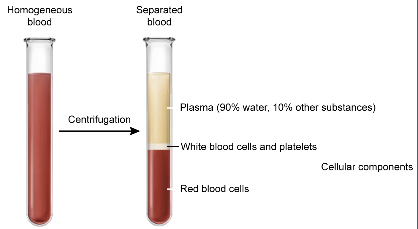 <p>is the liquid portion of blood.&nbsp; It is made up of water, electrolytes, gases, hormones, nutrients, metabolic waste, and PROTEINS.</p><p></p>