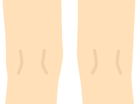 <p>back of knee</p>