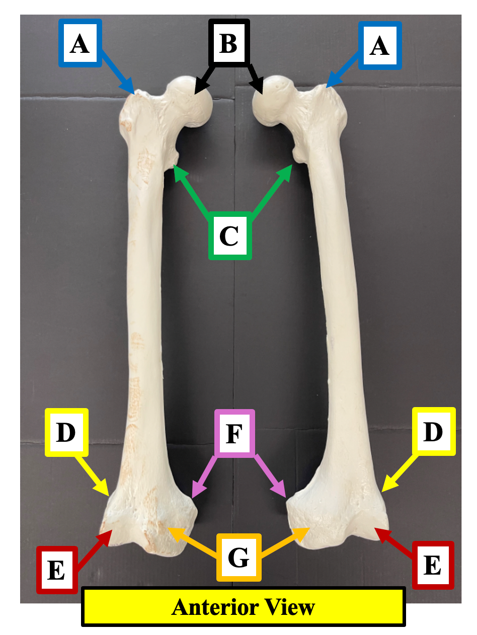 <p>Identify the name of the bony landmark of the femur that label <strong>D </strong>is pointing to. </p>