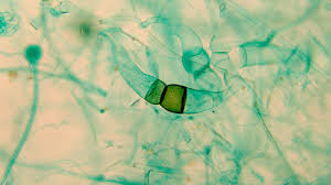 <p>What stage is this?</p>