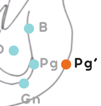 <p>Punto Pg'</p>