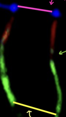 <p>What red/green border?</p>