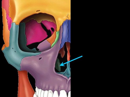 term image