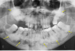 <p>describe the appearance of the lesion:</p>