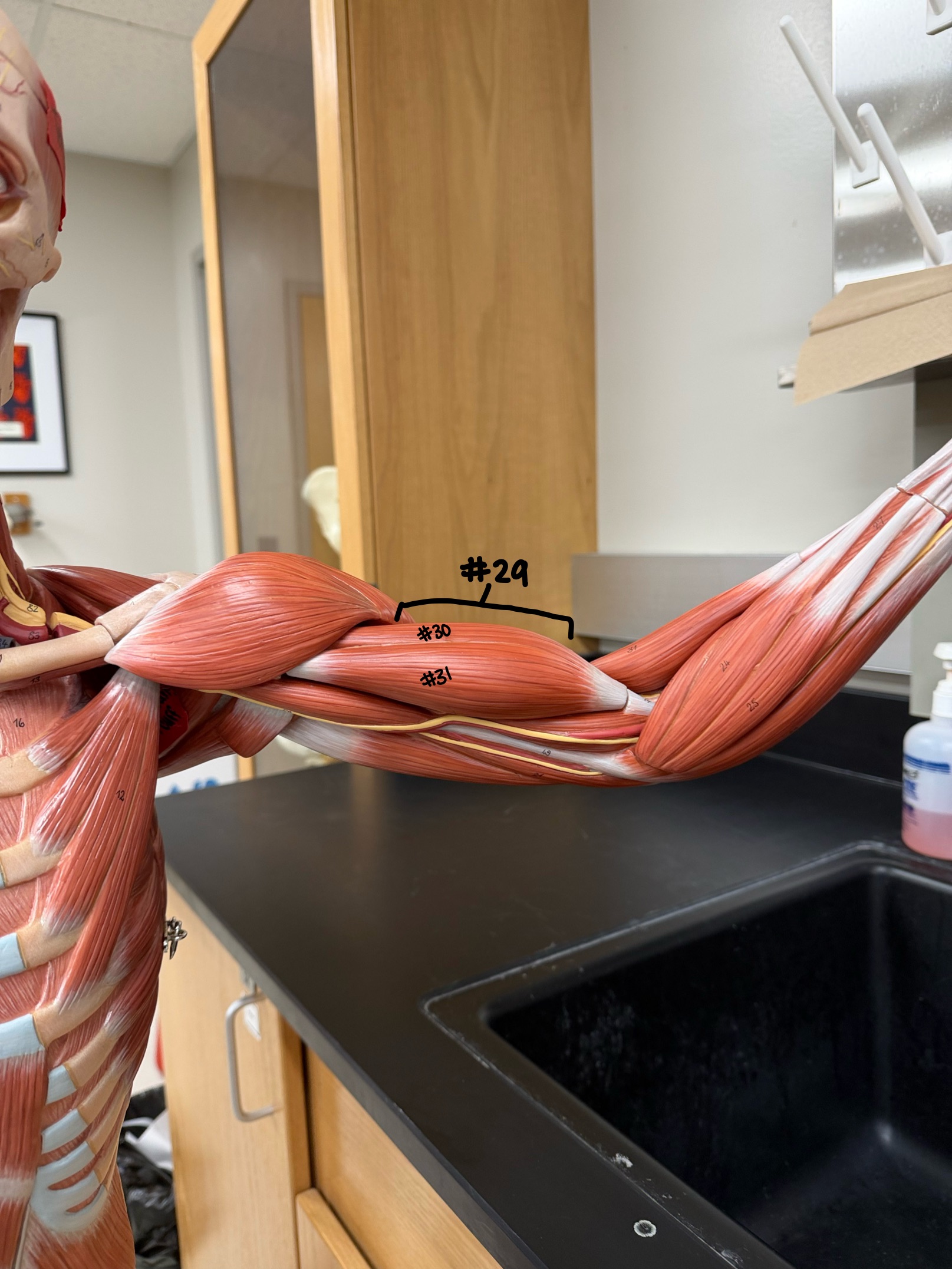 <p>What head of the Bicep Brachi is labeled #30?</p>