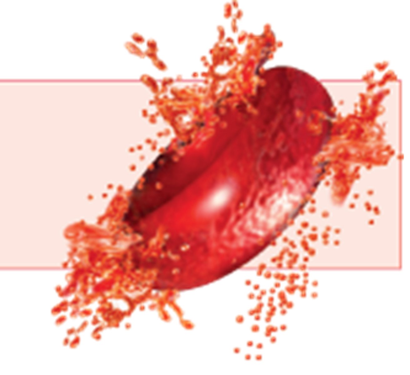 <p>Cell membrane bursts due to excessively high water pressure.</p>