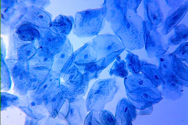 <p><span>What cell types are shown on the above microscope image?</span></p>