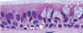 <p>Slide 9</p>