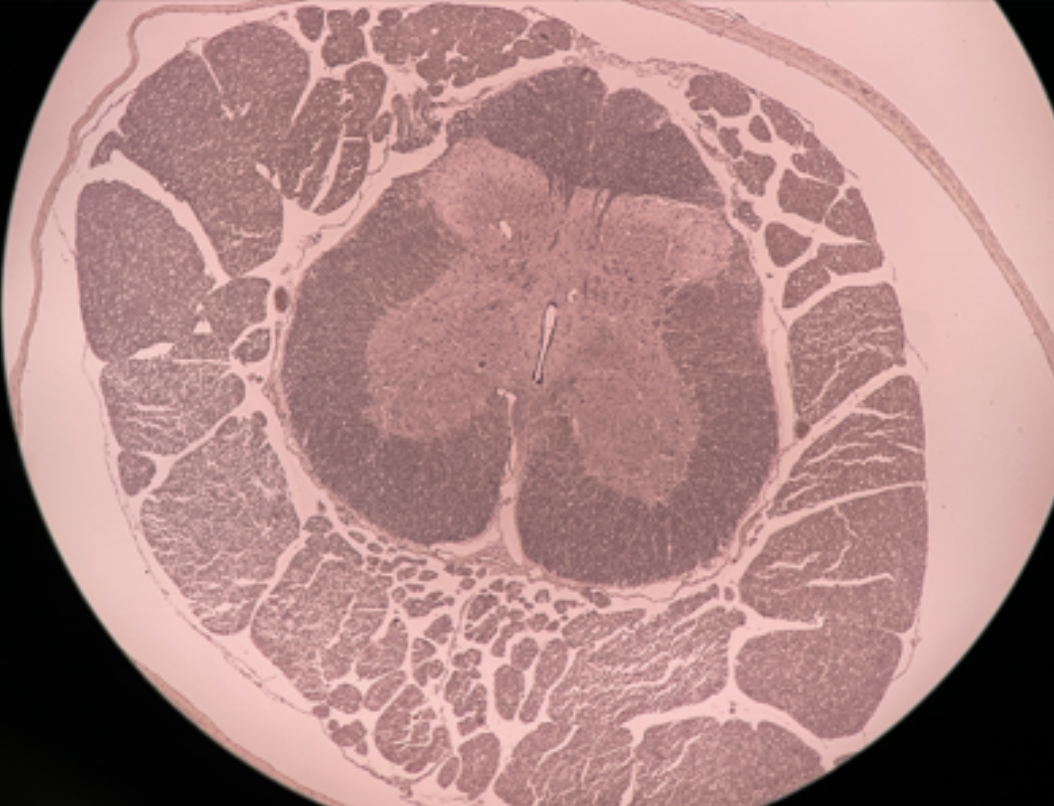 <p>Identify the region of the spinal cord this cross section is from.</p>