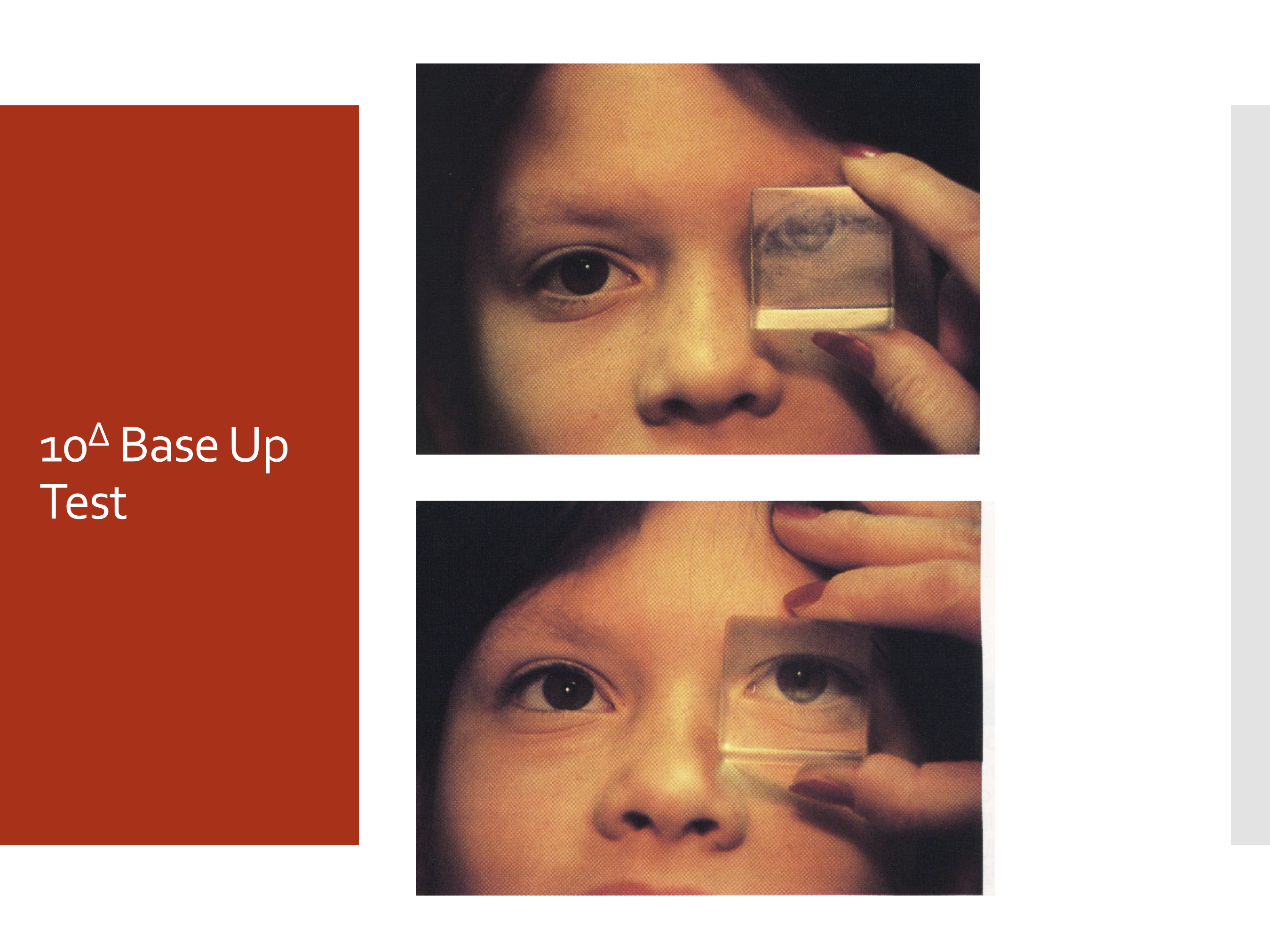 <p>Place a 10 prism diopter base-up prism in front of one eye while the patient views a target, then compare the response when the prism is placed in front of the other eye.</p><p></p>
