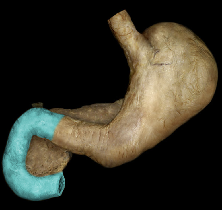 term image