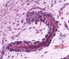 <p>What is indicated by the arrow?</p>