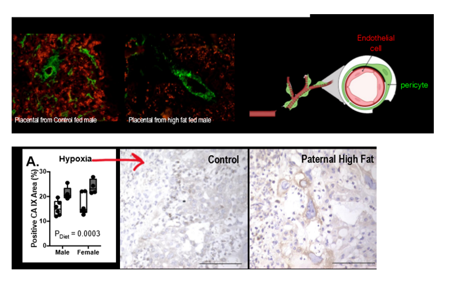 <p>induces placental hypoxia and sex-specific impairments in placental vascularization and offspring metabolism. paternal hf diet induced obesity contributes to poor vessel integrity (lack of pericytes) in the placenta. paternal obesity → bad placental vasculature → hypoxia. bad bc then fetus doesn’t get its oxygen to live and grow</p>