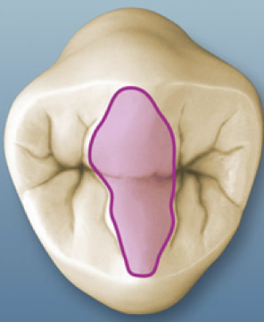 <p>The union of two triangular ridges crossing transversely across the surface of a posterior tooth</p>