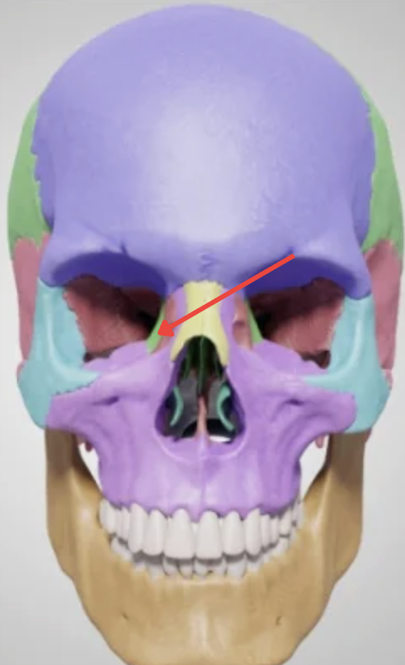 term image